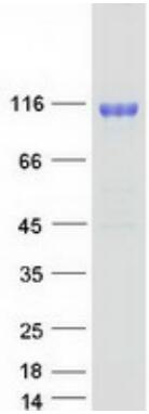 Coomassie blue staining of purified NCSTN protein.